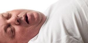 A relação invisível entre o ronco / apneia do sono e o sobrepeso
